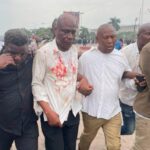 RDC : « Les opposants se sont servis du sang d&rsquo;animaux immolés transportés dans des bouteilles », le pouvoir ignore le bilan humain du sit-in et parle d&rsquo;une «mise en scène»